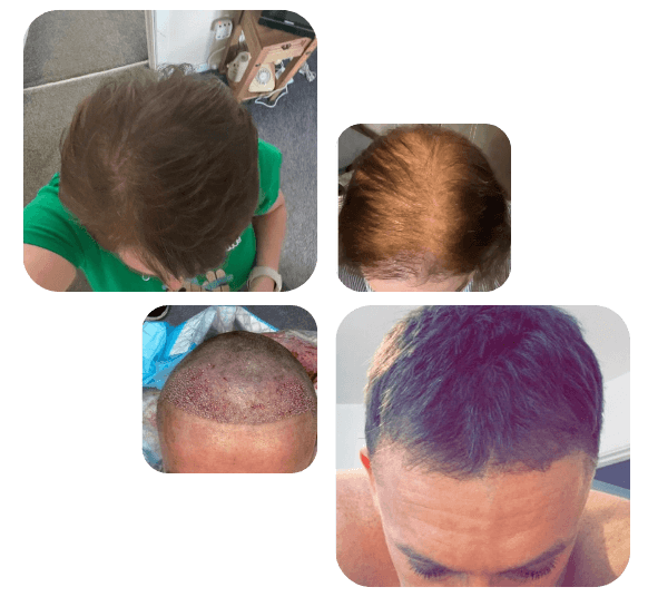 Transformation